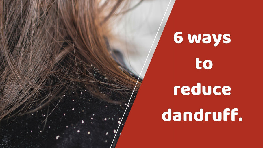 6 ways to reduce dandruff.