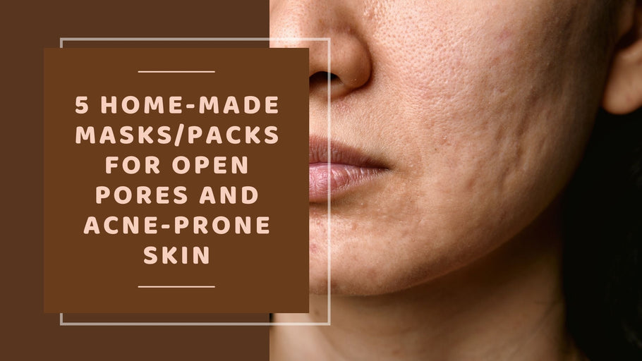 5 Home-made Masks/Packs for Open Pores and Acne-Prone Skin