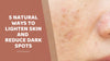 5 natural ways to lighten skin and reduce dark spots
