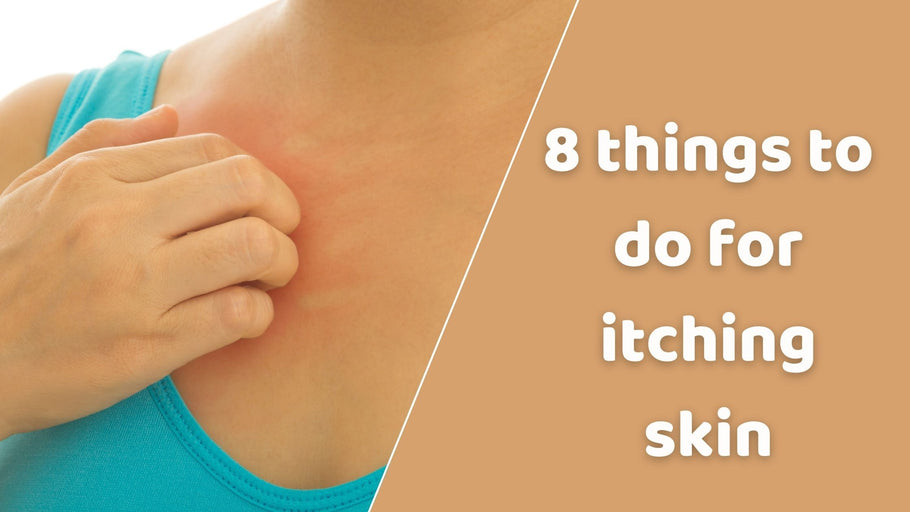 8 things to do for itching skin.