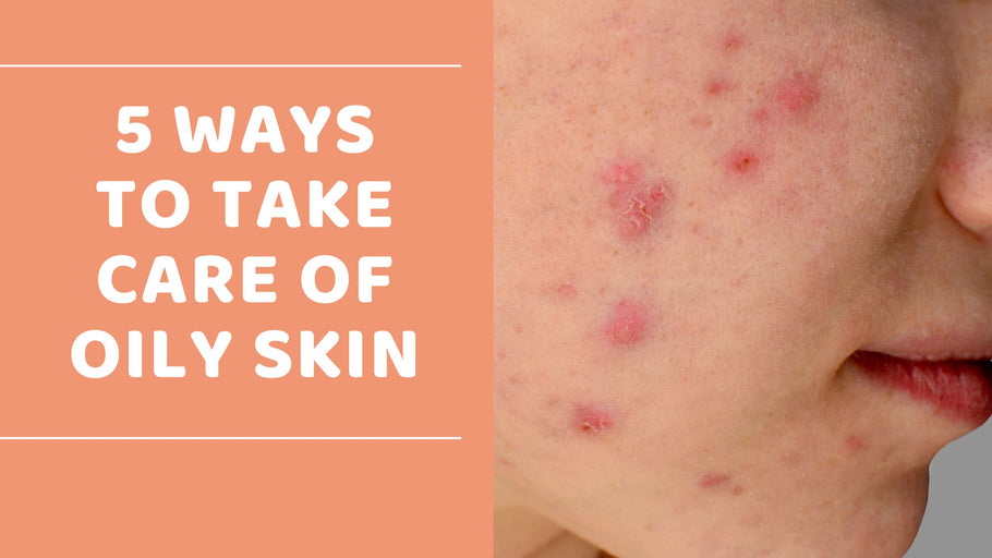 5 ways to take care of oily skin