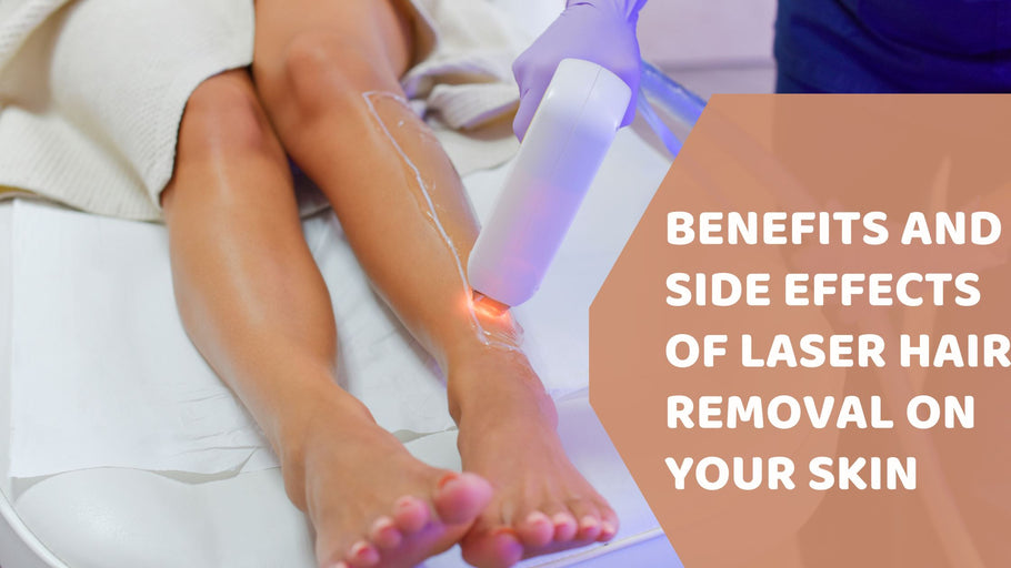 Benefits and Side Effects of Laser Hair Removal on Your Skin