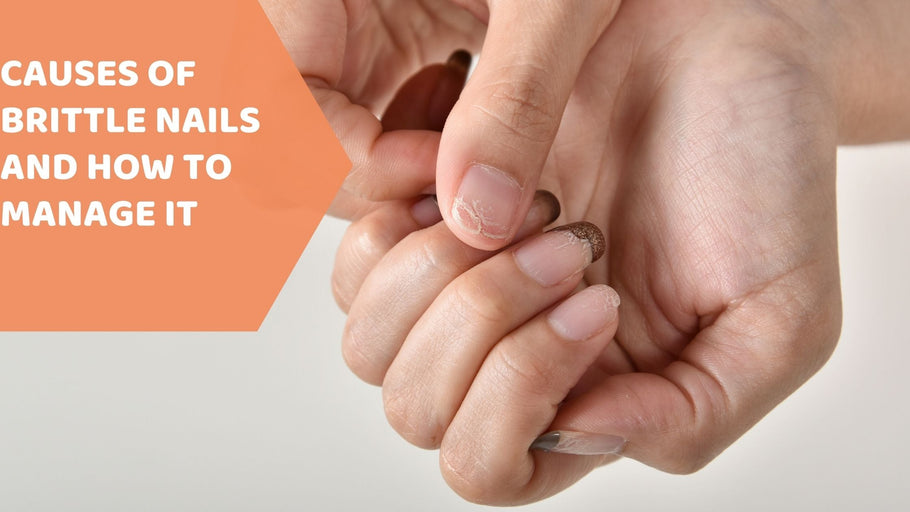 Causes of Brittle nails and how to manage them 