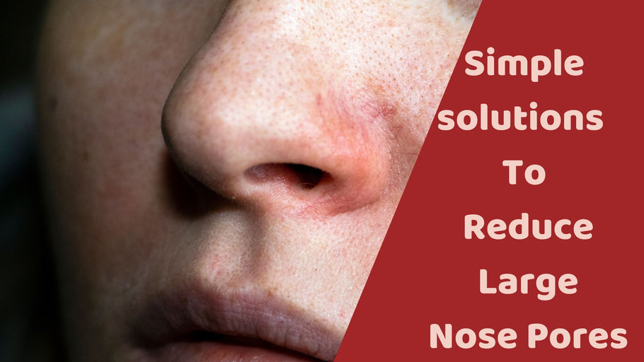 Simple Solutions To Reduce Large Nose Pores