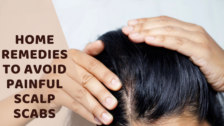 Home Remedies To Avoid Painful Scalp Scabs